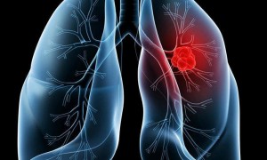 UCL研究人员发现吸电子烟和新冠肺炎之间没有联系