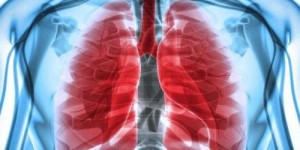 有抽电子烟得了肺癌的案例吗？