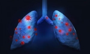 戒烟后如何清洁肺部？